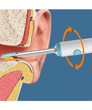 WiFi Smart Earwax Removal Tool with HD Visuals - Safe & Efficient Cleaning - Buy Online on GoSupps.com