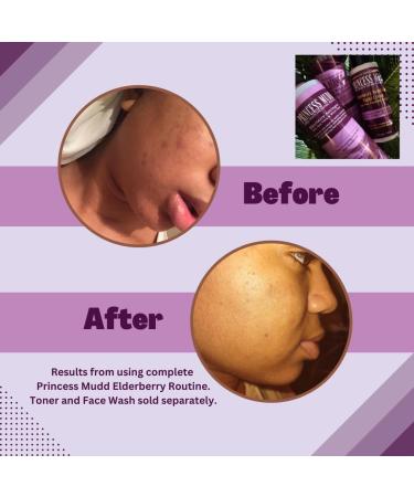 Princess Mudd Aloe Vera Face Cream - Age-Defying Radiance Non-Comedogenic with Chicory Root & Elderberry - 4oz | International Shipping - Buy Online on GoSupps.com