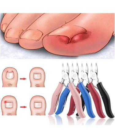 SJLS Stainless Steel Nail Cuticle Scissors Foot Care Toe Thick Finger Clippers Toenails Nippers Dead Skin Remover New Pedicure Tools (Color : Black) Black Blue - Buy Online on GoSupps.com