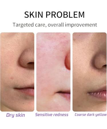 Tallow Balm - Moisturiser for Dry Skin - Body Lotion - Beef Tallow Lavender Body Moisturiser for Women&Men - Nourish Smooth Body Cream - Repair Barrier Face Moisturiser Balance Oil Body Care - Buy Online on GoSupps.com