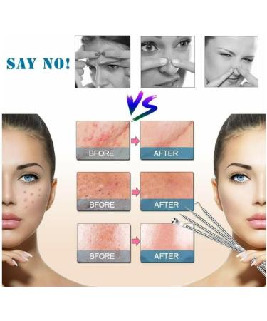 8 Pcs Ear Pick & Blackhead Remover Kit with Storage Box - Earwax Removal & Cleansing Tool Set - Buy Online on GoSupps.com