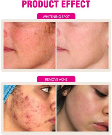 33 50 g snail cream day and night antiwrinkle care with snail mucus extract a moisturizing repair cream regenerates the skin and intensively moisturizes - Buy Online on GoSupps.com