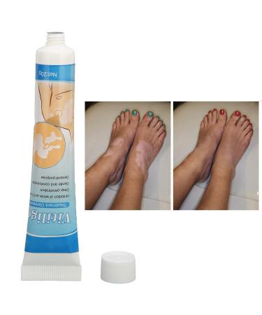 LIULDASHUN Vitiligo Cream - Natural Herbal Extract Treatment Ointment for Skin Pigmentation - 0.7oz - Buy Online on GoSupps.com