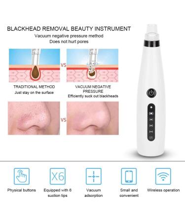 Qukaim Blackhead Removal Instrument Electric Blackhead Removal Suction Instrument Face Pore Acne Cleaner White - Buy Online on GoSupps.com
