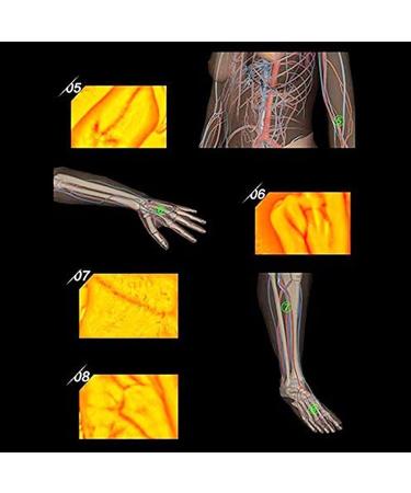 Buy Ssddlzeq Venenfinder Viewer - Portable Blood Vessel Finder for Easy Subcutaneous Vein Detection in Older Children - International Shipping Available - Buy Online on GoSupps.com