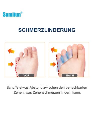 Sumifun Gel Toe Spreader - 10x Small Toe Protection for Overlapping & Curled Toes | Blue Gel Separator for Friction Pain Relief - Buy Online on GoSupps.com