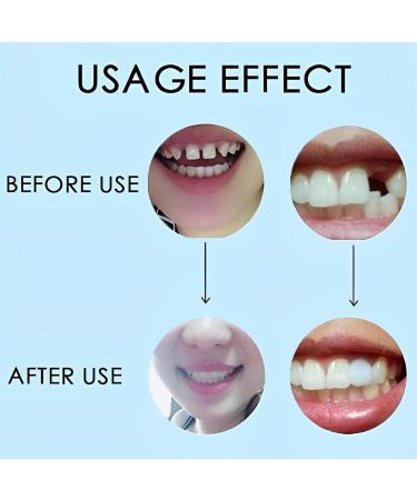 2 Pairs Adjustable Temporary Teeth - Nature-Friendly & Comfortable for a Confident Smile - International Shipping - Buy Online on GoSupps.com