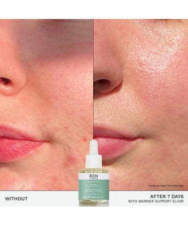 REN Clean Skincare Evercalm Barrier Support Elixir - Soothing Serum - Buy Online on GoSupps.com