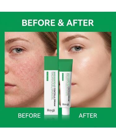 WestShiny Natural Madagascar Centella Cream 50g Deep Hydration for Dry Skin Daily Skincare to Soothe Revitalize & Soften Skin Suitable for Seasonal Changes & Air-Conditioned Rooms - Buy Online on GoSupps.com