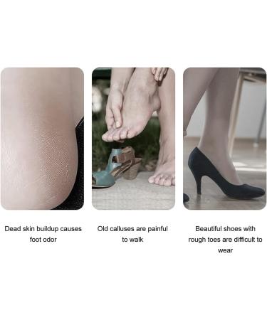 Electric Foot Callus Grinder Rechargeable Heel Callus Remover Cracked Heel Repair Tool for Dead Skin Exfoliation - Buy Online on GoSupps.com