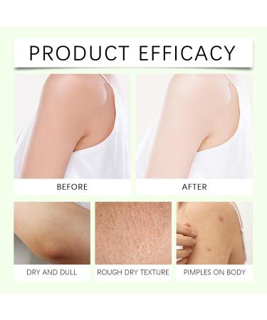  Generisch Oasis Neuropathy Cream Magnesium Body Butter Deeply Moisturizing Skin Stays Soft and Smooth Suitable for All Skin Types Skin Care Soothing Repair Barrier 114g (3) - Buy Online on GoSupps.com