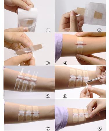 Laceration Wound Closure Device - Emergency Closure Strips for Fast Repair - Buy Online Ships Worldwide - Buy Online on GoSupps.com