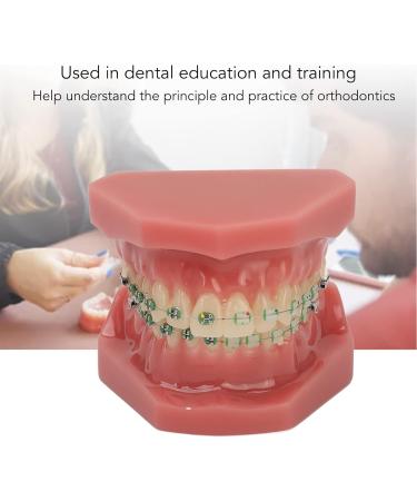 Orthodontic Bracket Model - Dental Resin Model & Portable Metal Wire for Student Learning - Buy Online on GoSupps.com
