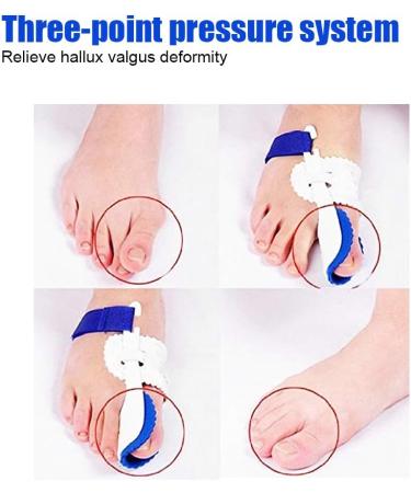 Bunion Corrector & Big Toe Separator | Hallux Valgus Splints for Men & Women | Pain Relief Foot Care Solutions - Buy Online on GoSupps.com
