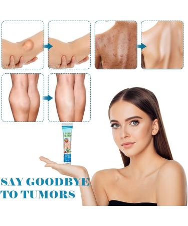 Buy FENGYANG 2PCS Lipoma Removal Cream - Herbal Solution for Lipom Lumps & Lymphatic Detox - Buy Online on GoSupps.com