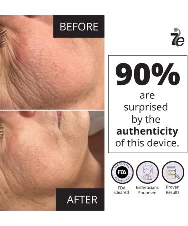 7E Myolift Face Lifting Device Mini Microcurrent Facial Device for Face Stimulation Non-Invasive Anti-Aging Skin Tightening Esthetician Supplies & Skin Care Tools - Buy Online on GoSupps.com