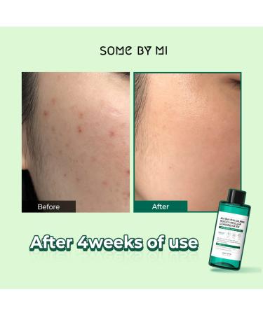 Buy SOME BY MI AHA BHA PHA Calming Truecica Micellar Cleansing Water - 300ml | Mild Daily Cleanser for Sensitive Skin - Buy Online on GoSupps.com