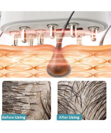 Opuscalp Advanced Scalp Care Massager | Portable 2-in-1 Electric Brush | Waterproof Handmade Skin Scratcher & Head Massage Device for Ultimate Relaxation - Buy Online on GoSupps.com