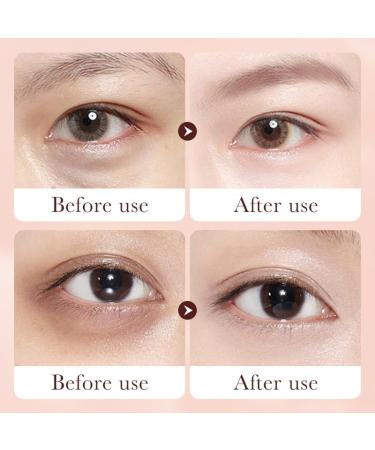  homomdy Turmeric and retinol eye cream - For dark circles and puffy eyes - Anti-wrinkle eye cream - Reduces fine lines - Anti-aging - Firming and lifting - Moisturizing - Buy Online on GoSupps.com