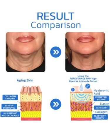 |Most Gifted| Age Reverse Ampoule Serum - 2024 New Anti-Aging Regenerative Ampoule Serum - Anti Aging Face Serum - Firm Skin and Reduce Wrinkles - Rejuvenate Youthful Skin (3Box - 90Pcs) - Buy Online on GoSupps.com