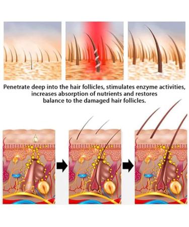 Hair Growth Promoting Oil Natural Organic Hair Growth Oil Essence Fast Natural Hair Growth for Thick and Fluffy Hair Growth  - Buy Online on GoSupps.com
