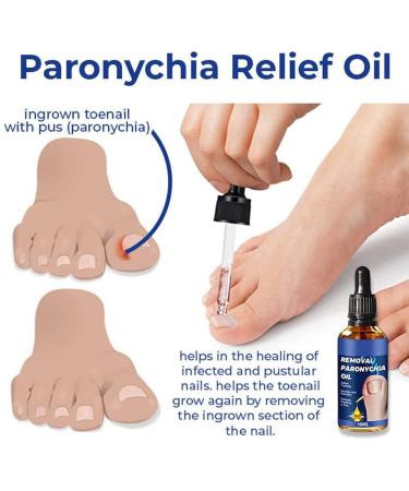 3Pcs German Toenailcare Removal Paronychia Oil for Healthier Toenails - Buy Online on GoSupps.com