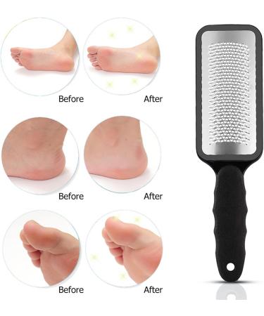 Foot Rasp and Callous Remover for Extra Smooth Feet - Foot File for Pedicure and Corn Removal - Black - Buy Online on GoSupps.com