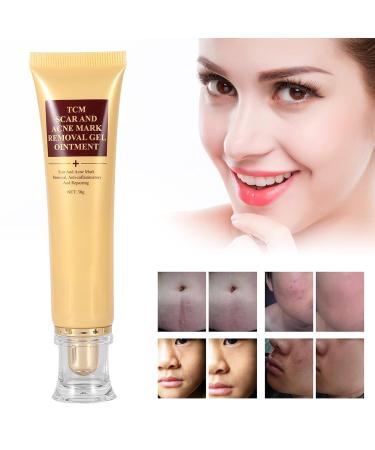 30g Scar Removal Cream for Acne Marks, Pimple, Blemishes, Stretch Marks, Burns - Treatment Ointment - Buy Online on GoSupps.com