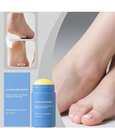 Foot Balm Stick 30 g Skin Softening Care Butter Moisturizing Foot Cream for Softening Dry Areas of the Body Recommended for the Whole Family - Buy Online on GoSupps.com