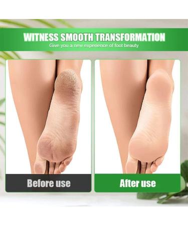 Stainless Steel Pedicure Foot File Knife - Foot Care Tool for Smooth Feet (Black) - Buy Online on GoSupps.com