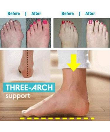 PROPFE Women Toe Straighteners Platform Sandal Bunion Splint Pain Relief Shoes - Hallux Valgus Correction - Comfy Beach Travel Sandal - Buy Online on GoSupps.com