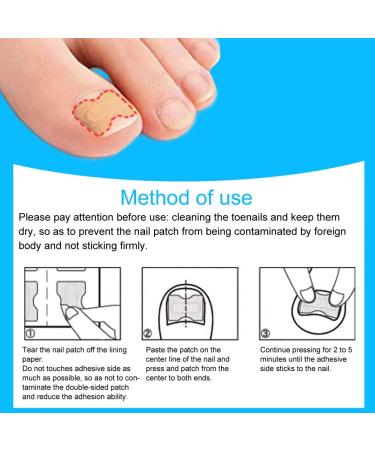 Toenail Corrector Patch Ingrown Toenail Corrector Toenail Correction Stickers Ingrown Toenail Correction Patch Foot Care Pedicure Sticker Toenail Treatment Tool for Foot Care (72 pieces) - Buy Online on GoSupps.com