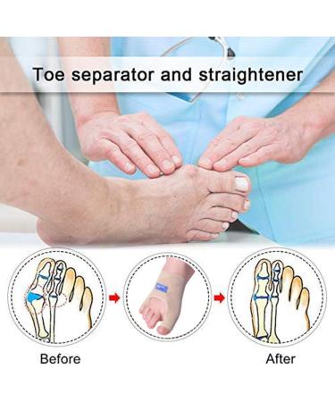 ENPAP Toe Spacers Straightener Corrector Big Splint Protectors Support Sleeve for Valgus Pain Relief | Silicone Separators and Pad | Left & Right - Buy Online on GoSupps.com