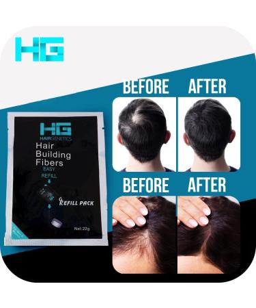 Hair Genetics Hair Fibres White 22g Refill Pack - Effective Solution for Hair Loss and Thinning - 22g (Pack of 1) White - Buy Online on GoSupps.com