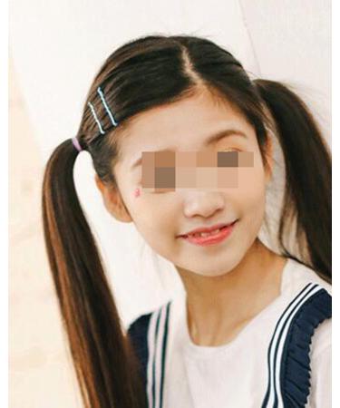 50 Colorful Wave Bobby Pins for Stylish Hairdos - Shop Now! - Buy Online on GoSupps.com