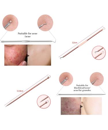 Blackhead Remover Pimple Extractor Tool Kit - Acne Treatment for Blemish & Whitehead Removal - 4 Piece Set with Case - Buy Online on GoSupps.com