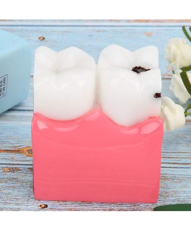 High-Quality Dental Prosthesis Model for Oral Care | International Shipping Available - Buy Online on GoSupps.com