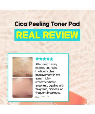 Elishacoy | TETRAFORCE Cica Peeling Toner Pads Gentle Exfoliating & Calming Toner with Cica Daily Skin Smoothing & Hydration Vegan & Dermatologist Tested 150 mL - Buy Online on GoSupps.com