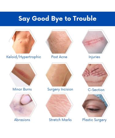 GOOODA Silicone Scar Sheets Strips Tape 4x7.5 - 5 Sheets | Scar Removal & Reduction for Surgical Treatment, Keloids, Burns, Tummy Tuck, Acne, C-Section, Stretch Marks | Silicone Cream - Buy Online on GoSupps.com