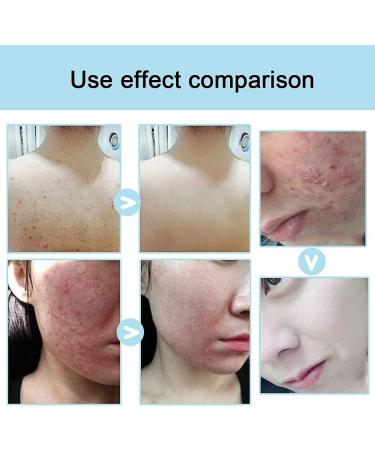 AJUMKER Sea Salt Soap Skin care Soap Handmade Goat Milk Cleaner Facial Repair Pimple Pores Removal Acne Treatment Moisturizing Face Care Soap - Buy Online on GoSupps.com