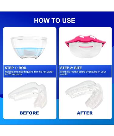 FDA-Cleared Anti Snoring Device - Customizable Mouthpiece for Men & Women | Comfortable & Effective Solution - Buy Online on GoSupps.com