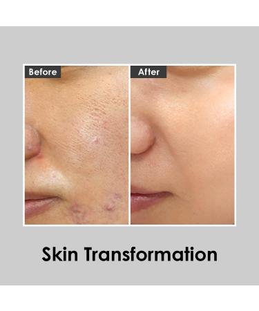 MEDI-PEEL Aqua Essence Peptide 9 Toner 8.45 fl oz | Anti-Aging Collagen Firming Toner - Korean Skincare for All Skin Types - Buy Online on GoSupps.com