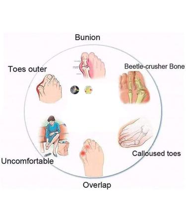 Women's Black Bunion Correction Sandals with Orthopedic Toe Ring | MisFun Orthopedic Flip Flops for Comfortable Support - Buy Online on GoSupps.com