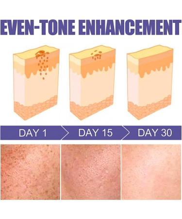 Skin Brightening Cream Intimate Area Cream Face Cream for Women Underarm Brightening Cream Effective for Armpit Knee Elbow Sensitive & Private Area Brighten Nourish Repair & Restore Skin - Buy Online on GoSupps.com