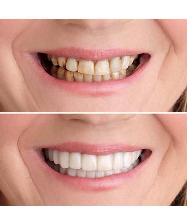 2 Pairs of Men's and Women's Temporary Cosmetic Confident Smile - Enhance Your Look Today - Buy Online on GoSupps.com