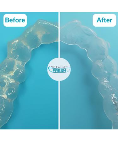 Retainer Cleaning Tablets - 120 Count for 4 Months Supply - Stain-Free & Fresh Brite - Cleaner for Retainer, Mouth Guard, Dentures, Aligners - Buy Online on GoSupps.com