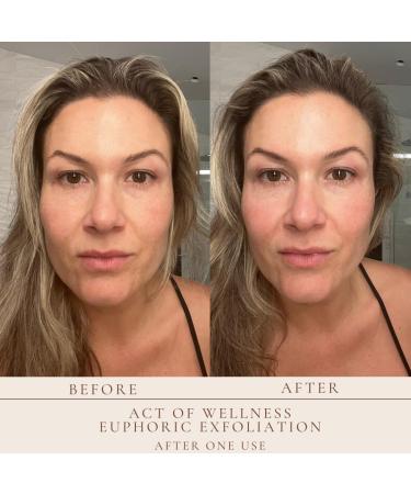 Act of Wellness Euphoric Exfoliation Weekly Exfoliating Facial Treatment Peel for Soft and Baby Smooth Skin - with Lactic and Glycolic Acid - Vegan (2oz and 1oz) - Buy Online on GoSupps.com
