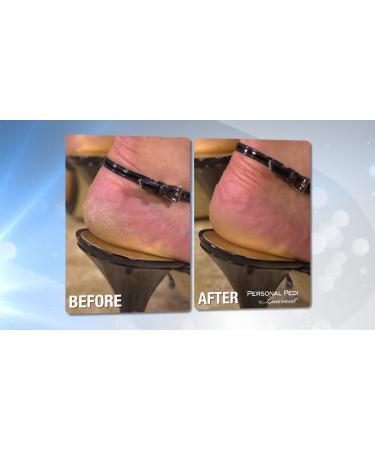 Rechargeable Personal Pedi Foot Callus Remover by Laurant - Smooth, Soft Feet Guaranteed - Buy Online on GoSupps.com