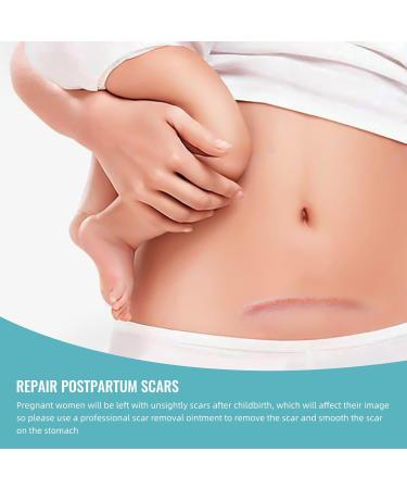 Advanced Scar Gel Treatment | Silicone Scar Removal Cream for Face C-Section Keloids & Acne Scars - Fast Shipping Worldwide - Buy Online on GoSupps.com