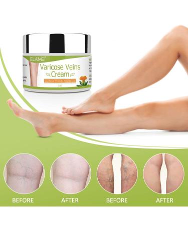 Natural Varicose Veins Cream | Effective Treatment for Tired Heavy Legs | Improve Blood Circulation - Buy Online on GoSupps.com